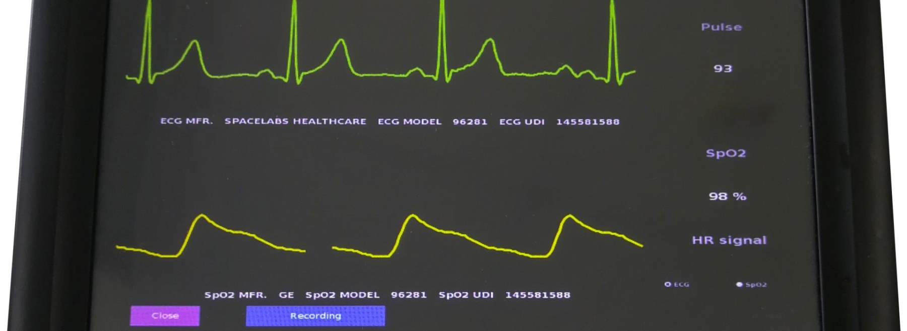 UniTransferklinik - SDC Patientenmonitor